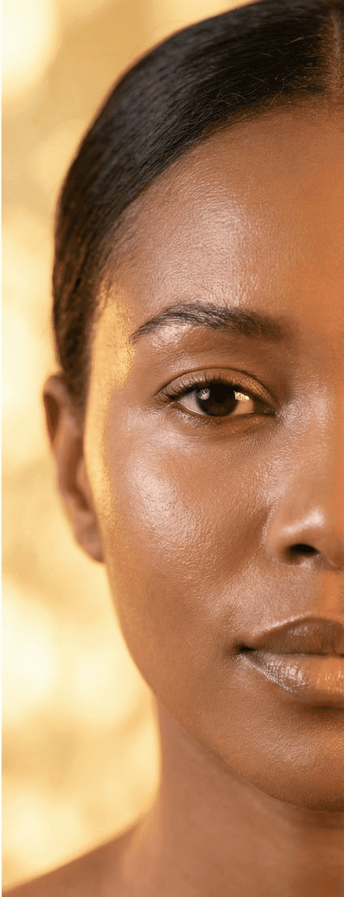 Depois - Harmonização facial